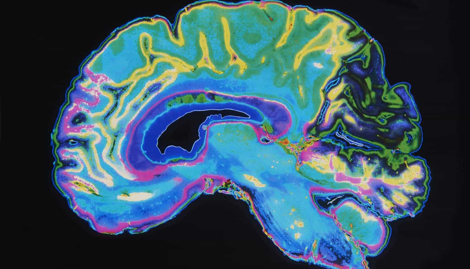 MRI image of brain showing AI technology and cyber defense