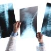 Radiologist checking an x-ray image showing DICOM vulnerability for health records
